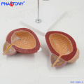 PNT-0569-2 PVC medical enlarged plastic people organ bladder model